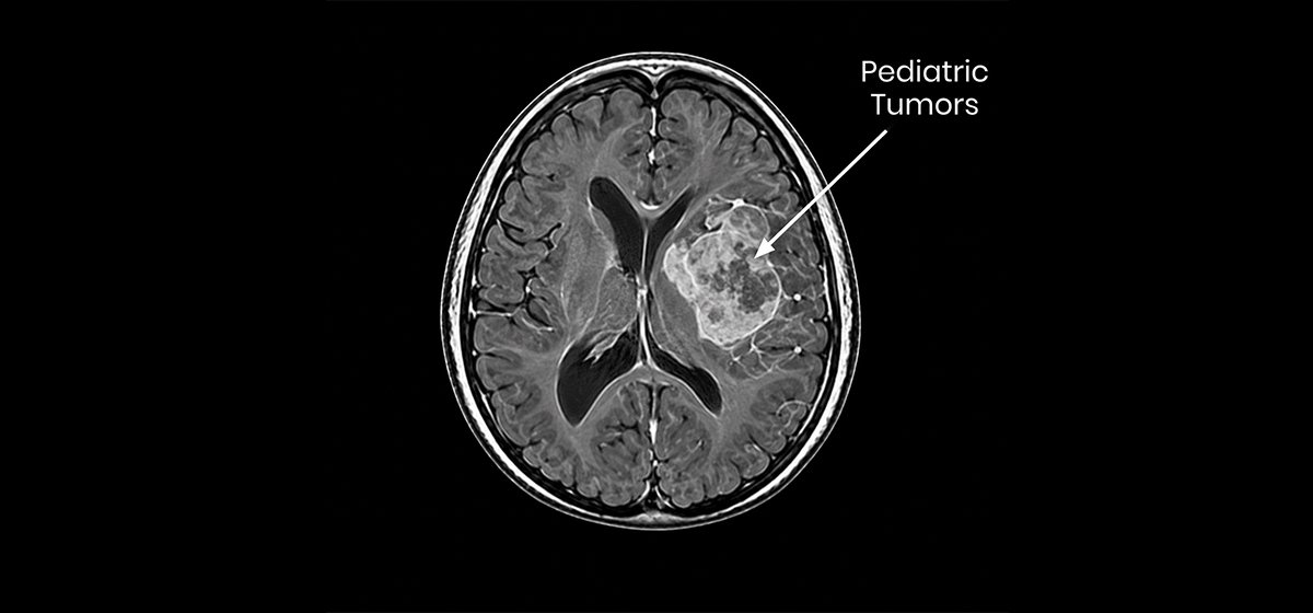 Pediatric Tumors