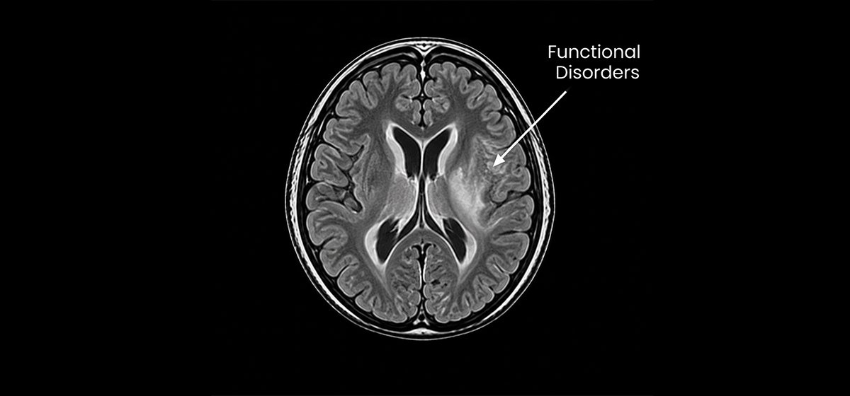 Functional Disorders and Cerebral Palsy